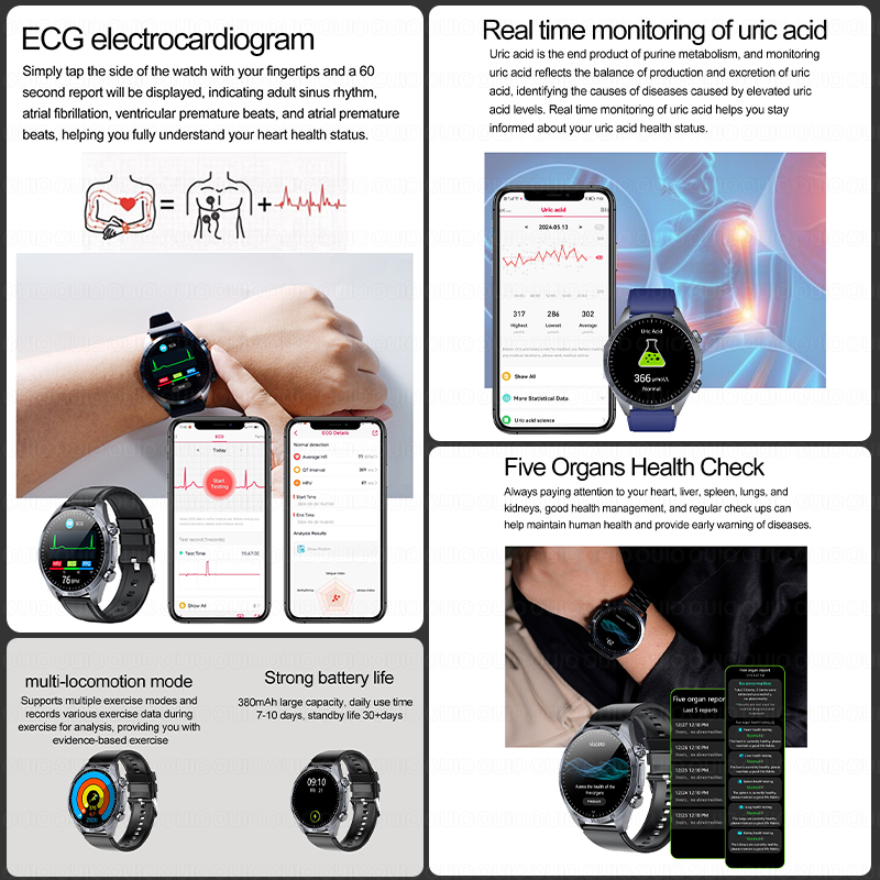 2026 Brand New Upgrade Health  - đánh giá và giá Smartwatch Watches For Women Branded